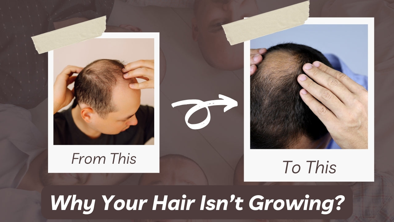 Why Your Hair Isn’t Growing (And How Natural Oils Help Over Time)