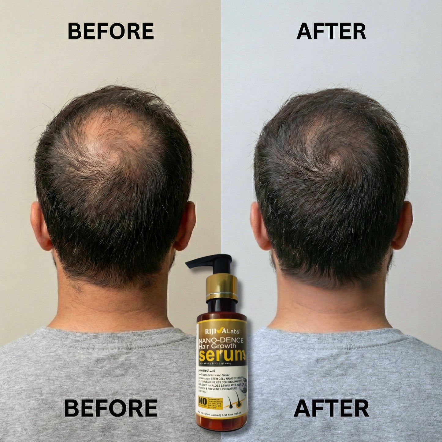 NANO-DENCE Hair Growth Serum for all hair problems (100 ML)